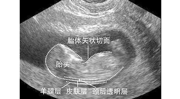 衡阳做单周期三代供卵做代怀机构要多少钱附医院费用成功率明细!