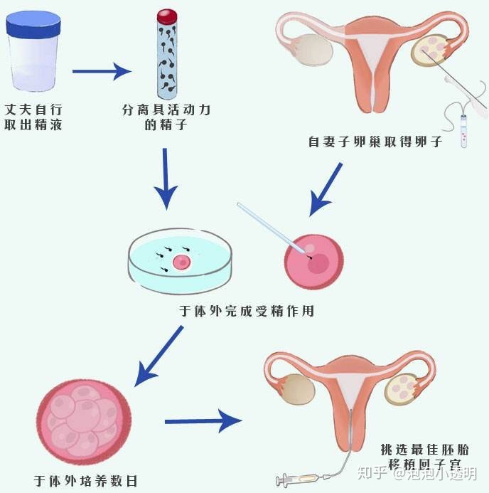 是否可以去美国抱供卵做赠卵试管代怀