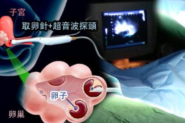 江苏南京妇幼保健院借卵做试管婴儿移植手术费用是多少