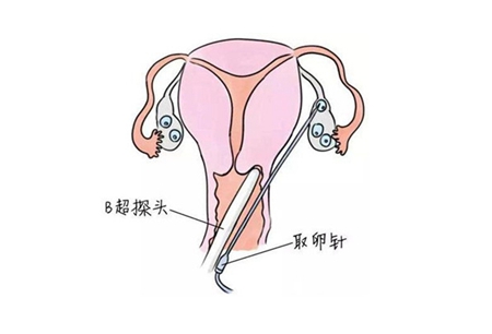 江苏南京第三代试管婴儿费用