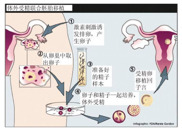 试管胚胎什么时候移植