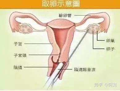 南京甘美医院做二代试管成功率高吗？
