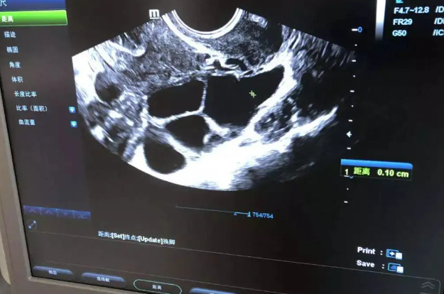 江苏南京供卵中介没作的吗（南京试管代怀女孩包成功）