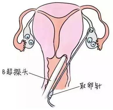 南京那家医院可以试管代怀费用和成功率婴儿