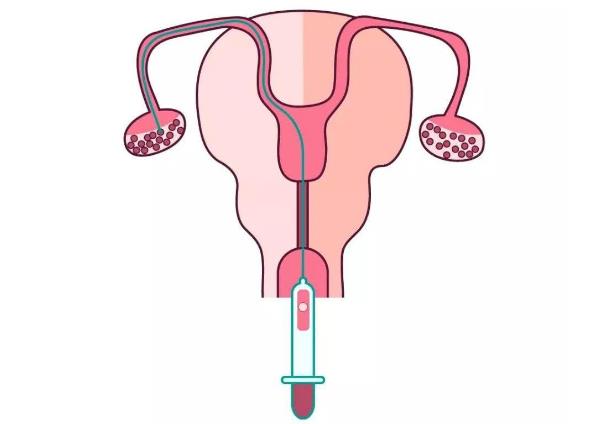 南京那家医院可以试管代怀费用和成功率婴儿