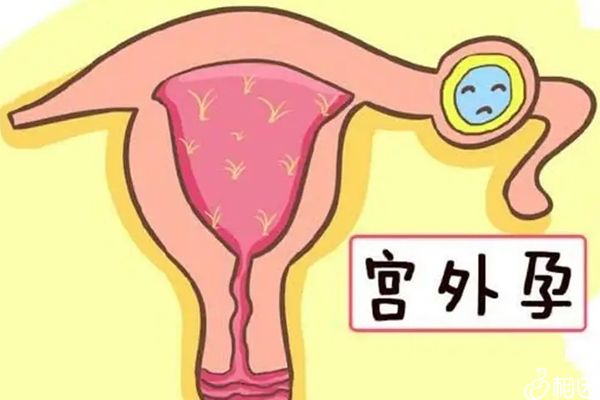 南京借卵试管代怀协会怎么收费