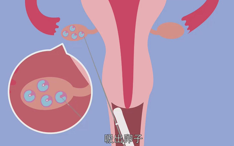 什么原因造成人工授精后出现一卵多精的异常情况
