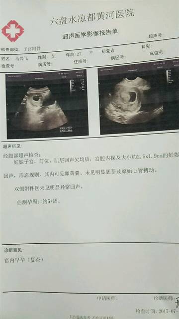 男人精子ab级活力低能生育吗（精子ab级35可以怀孕吗）