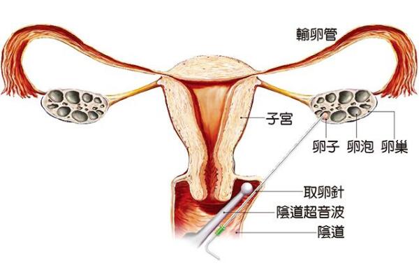 45岁绝经女性供卵做代生套餐的移植成功率解说