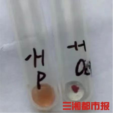 南京医科大学附属第一医院供精试管多少钱（十万够吗？）