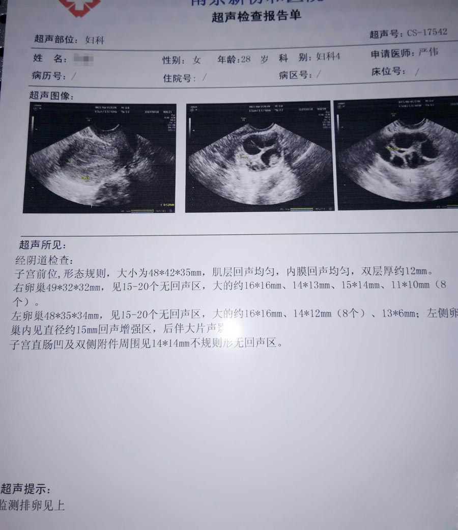 什么样的人容易生出女孩